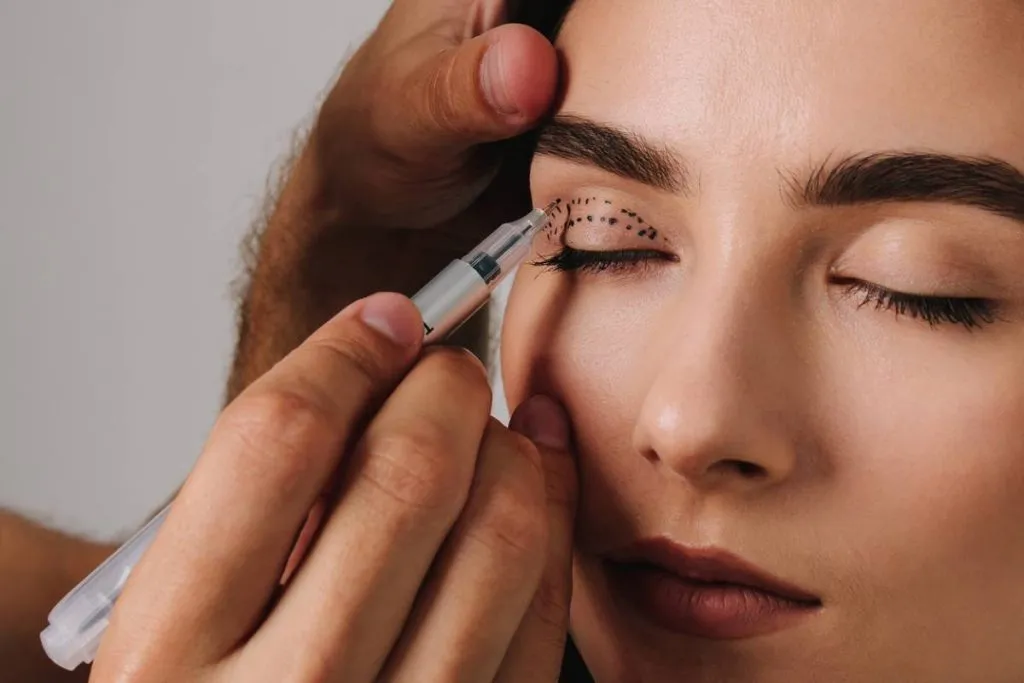 blépharoplastie Lyon chirurgie esthétique